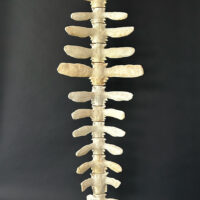 Bone Stack